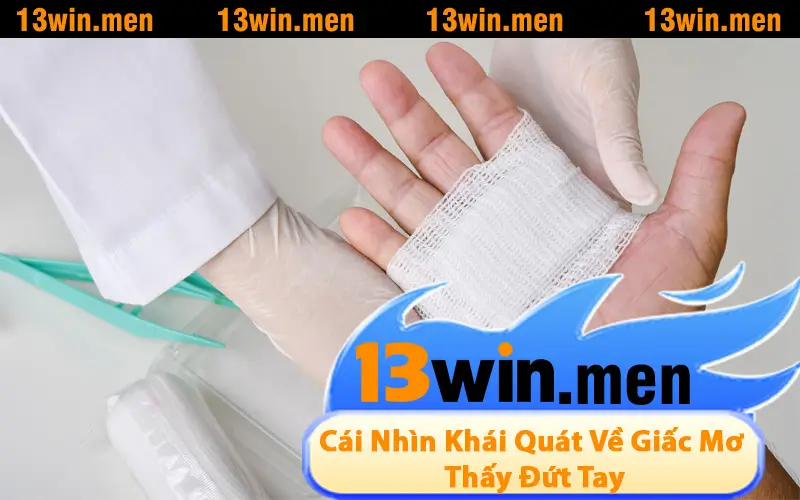 Cái Nhìn Khái Quát Về Giấc Mơ Thấy Đứt Tay